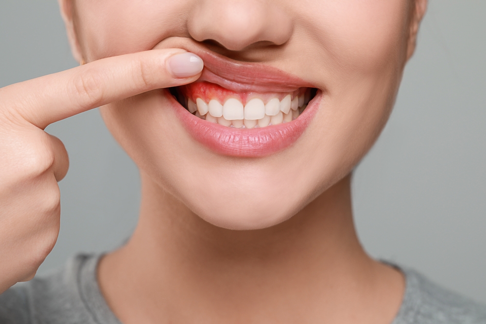 Close-up of bright, healthy smile, after Gingivectomy in Hobbs NM