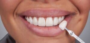 Cosmetic Dentistry Hobbs