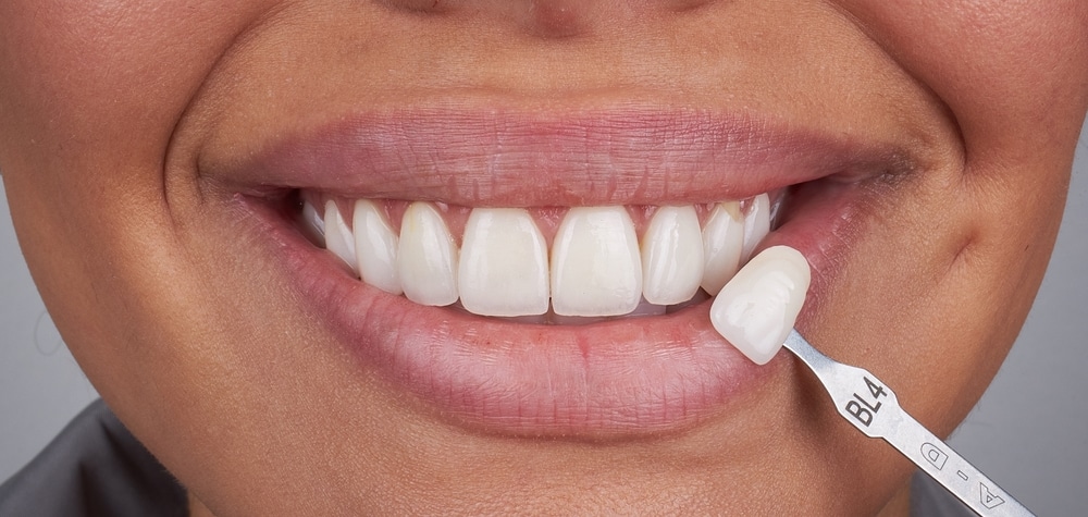 Cosmetic Dentistry Hobbs