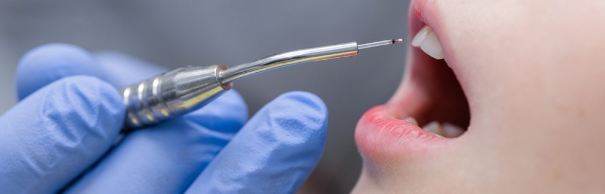 Diode Laser Dentistry